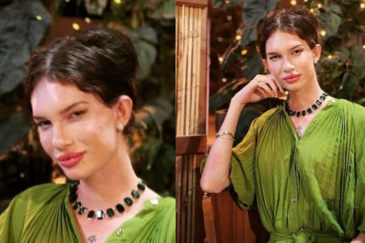 চেহারা বদলে বিপর্যয়: অস্ট্রেলীয় টিকটকার জোলেন ডসনের করুণ অভিজ্ঞতা