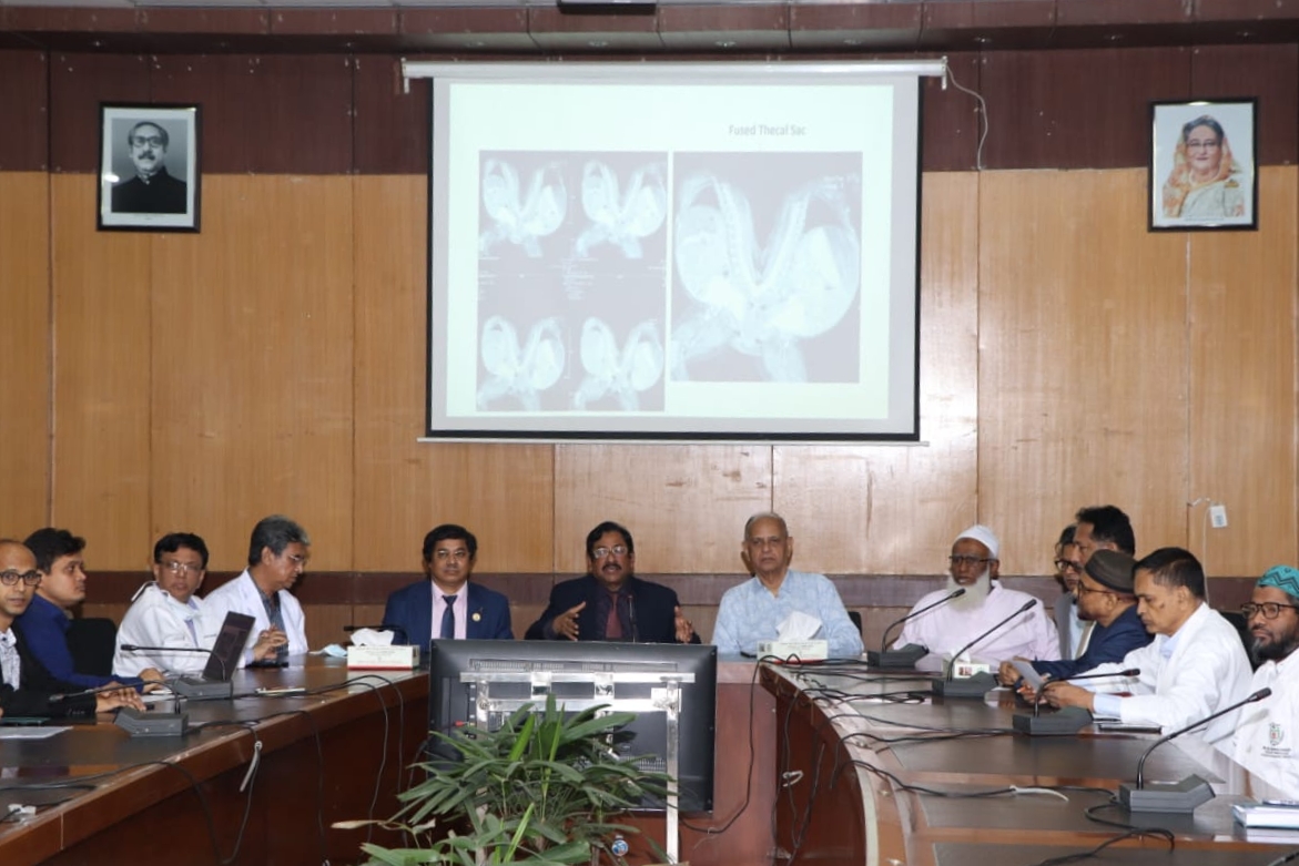 বিএসএমএমইউতে আলাদা হবে মেরুদণ্ড জোড়া দুই শিশু